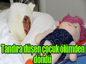 Tandıra düşen çocuk ölümden döndü