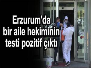 ERZURUMDA BİR AİLE HEKİMİNİN TESTİ POZİTİF ÇIKTI