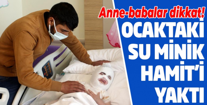 Başından aşağıya kaynar su dökülen çocuk feci şekilde yandı
