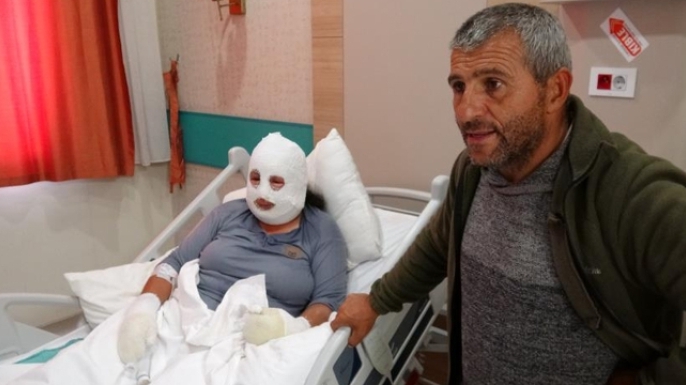 Anne kızını kurtardı, kendisi yaralandı