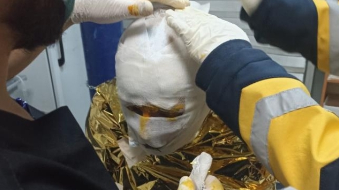 Gece vardiyasında dehşeti yaşadılar